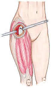 McKee, Farrar y Ring, Haboush, Urist y  McBride