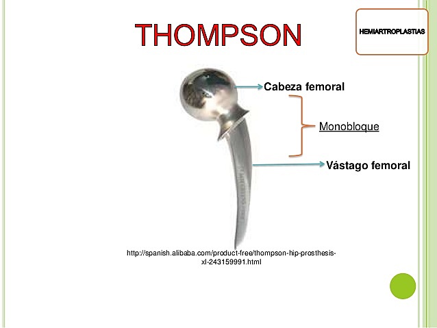 Se crea la prótesis de Thompson