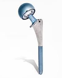 Endoprotesis femoral bipolar