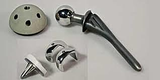 prótesis de nuevos materiales