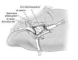 ABORDAJE MINIMAMENTE INVASIVO