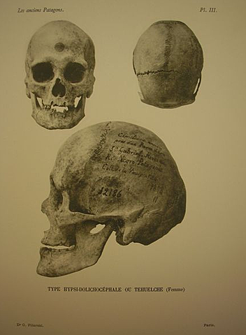 Sociedad Antropológica de París