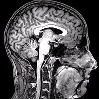 Timeline: Actividad 1: Foro ¿De dónde viene y para dónde va el cerebro?