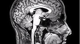 Timeline: Actividad 1: Foro ¿De dónde viene y para dónde va el cerebro?