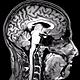 Fmri brain scan