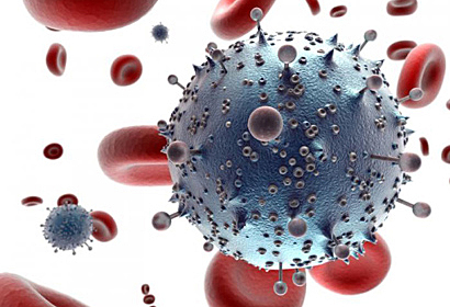 HIV / AIDS