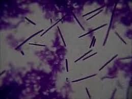 Ampliación del mundo submicroscopico