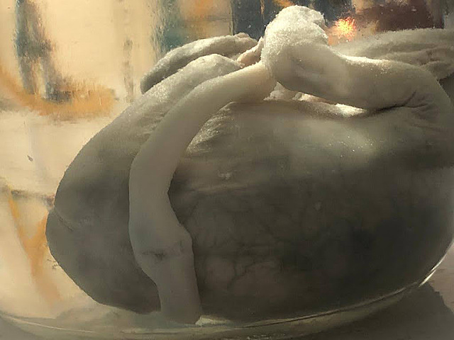 The fetus in the lab