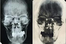 Identificación de cuerpo