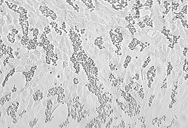 CDC successfully grows Sars-Cov-2 virus in cell culture