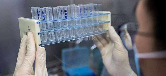 Coronavirus: Bolivia registra 632 nuevos contagios y 6 fallecidos