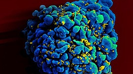 Timeline: Pandemias mas letales de mundo.