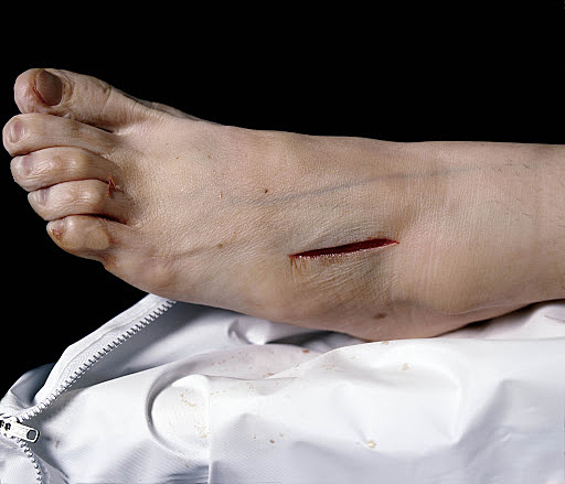 El depósito de cadáveres