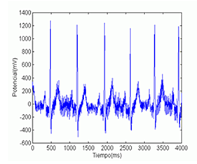 Señales biomédicas