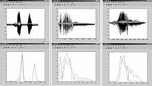 Grupo de Procesamiento de la Voz