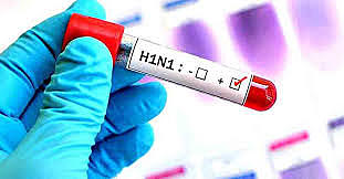 Pandemia por gripe A (H1N1)