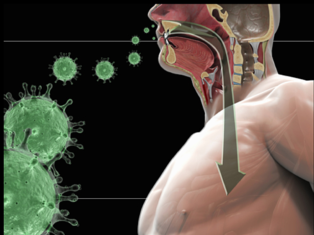 Simdrome respiratorio agudo grave