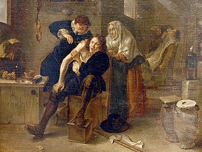 SIGLO XVIII Rechazo Barbero-Cirujano