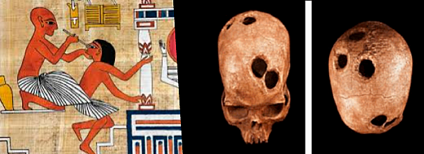 EDAD ANTIGUA 3000 a. C