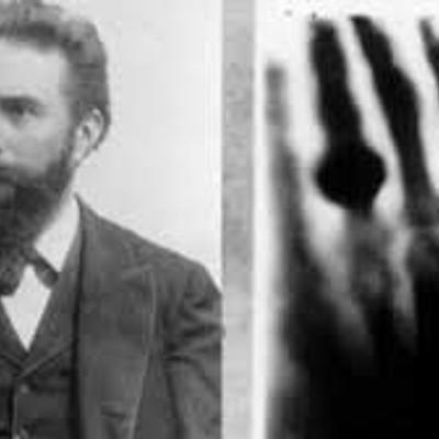 Timeline: HYSTORY OF X RAYS