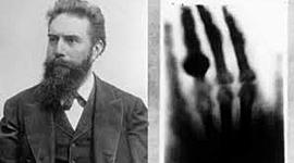 Timeline: HYSTORY OF X RAYS