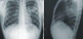 Presetation of the discovering