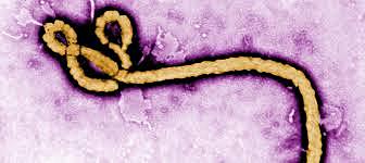 Ebola