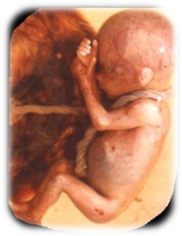 The Supreme Court angers social conservatives with its decision to legalize abortion in Roe v. Wade.