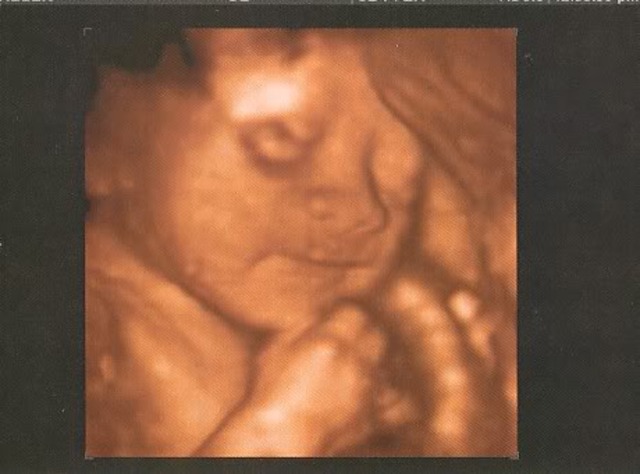 Supreme Court Angers Social Conservatives with Decision to Legalize Abortion