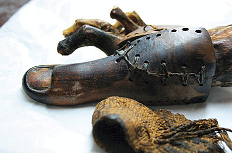 Oldest Prosthetic?