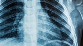 Timeline: X-RAY HISTORY