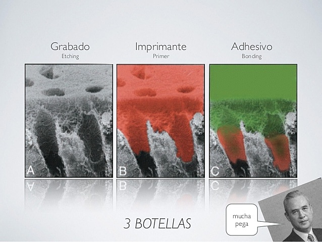 Acondicionado de la dentina