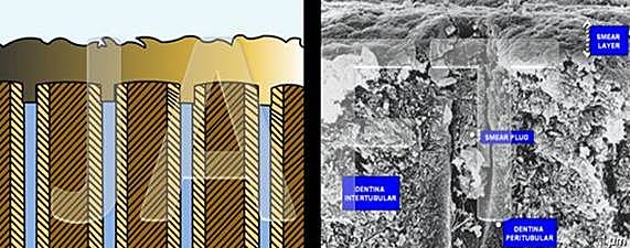 Capa hibrida o de interdifusión