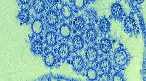 Virus H1N1