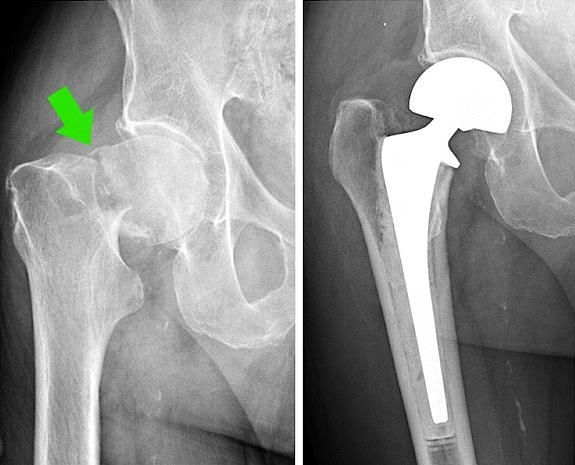 Atendimento Pré-Hospitalar