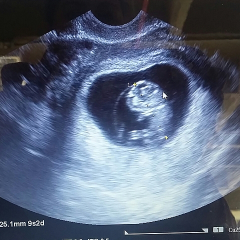 Cuando todo comenzó