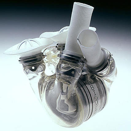 Artificial Heart Implant