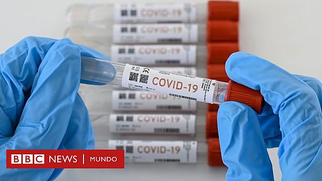 Las diferentes pruebas de coronavirus