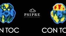 Timeline: Estudios del TOC y su neuroanatomía