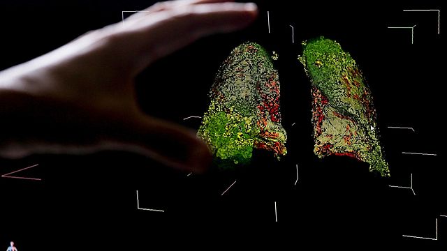 AVANCE DEL VIRUS EN MÍ