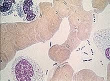 La plaga de justiniano