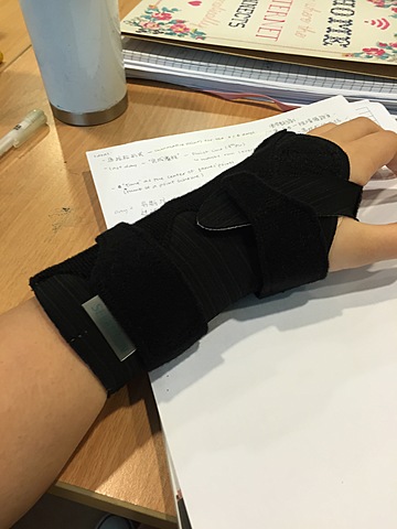 Temporary loss of mobility