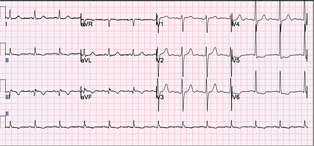 Triage Status: Urgent