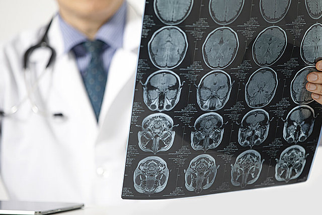 Prevención Terciaria Recomendaciones