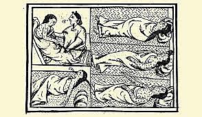 Epidemia de Viruela