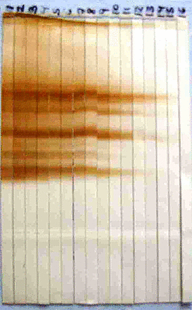 Técnicas inmunológicas