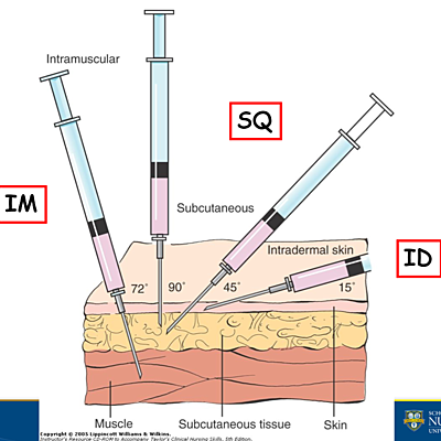 Timeline: Administering subcutaneous injections