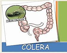 El Cólera