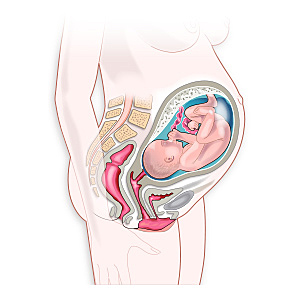 Implantacion De Tejido Congelado