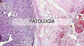 Timeline: INICIOS DE LA PATOLOGÍA LABORAL